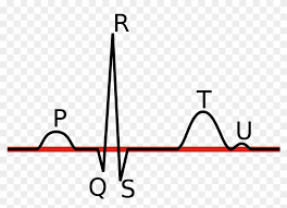 Linia Izoelektryczna Ekg Free Idea Png